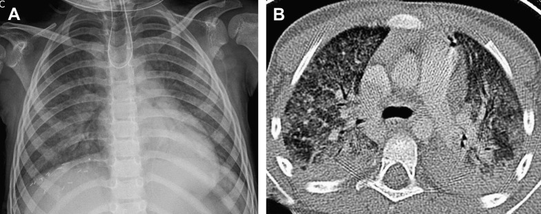 Fig. 23