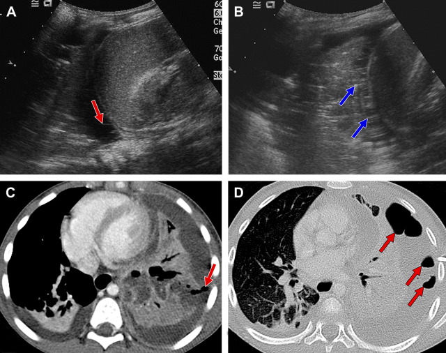 Fig. 26