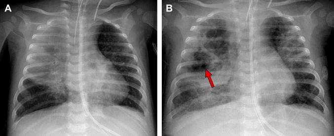 Fig. 18