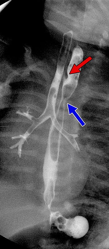 Fig. 14