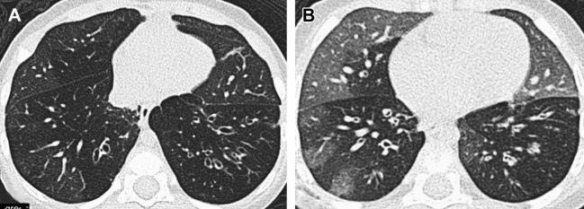 Fig. 28