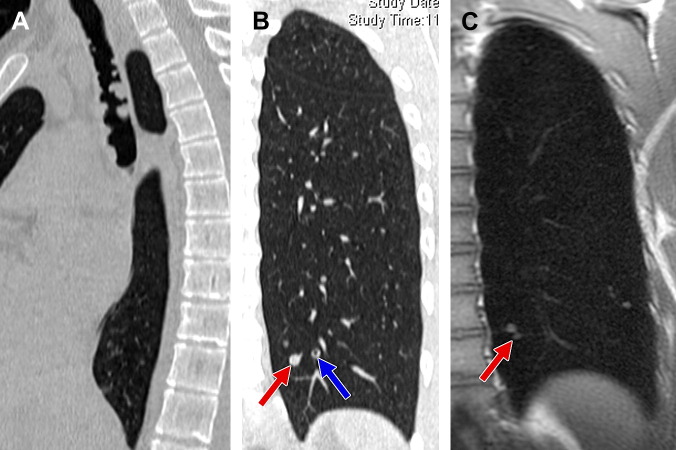 Fig. 1