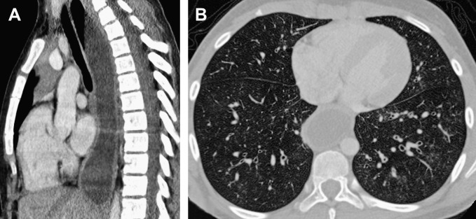 Fig. 13