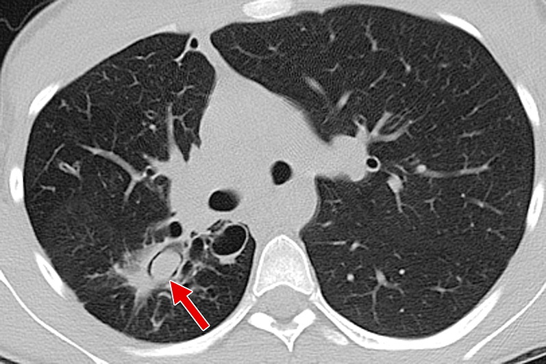 Fig. 17