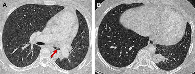 Fig. 16