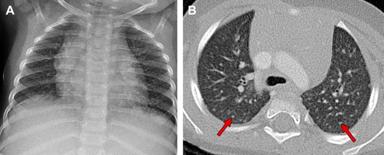 Fig. 10