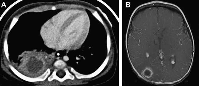 Fig. 25