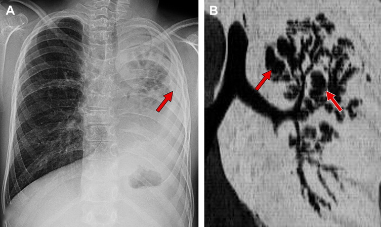 Fig. 27