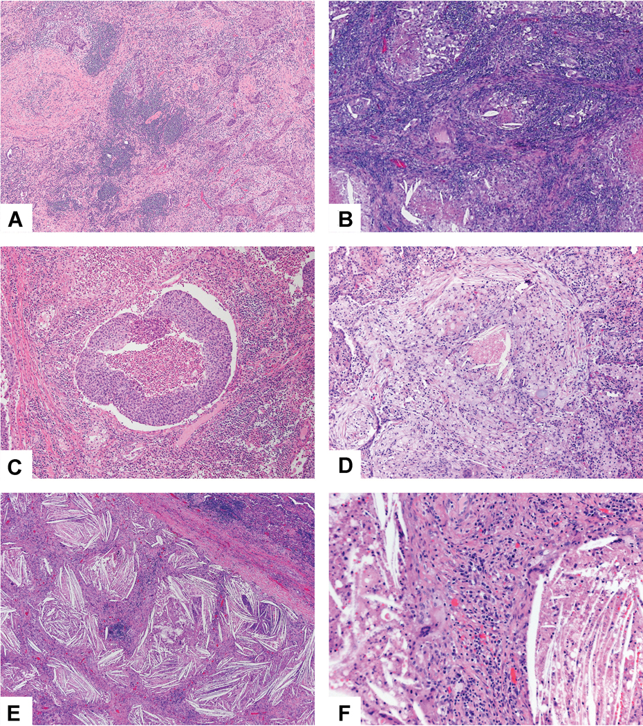 Figure 11: