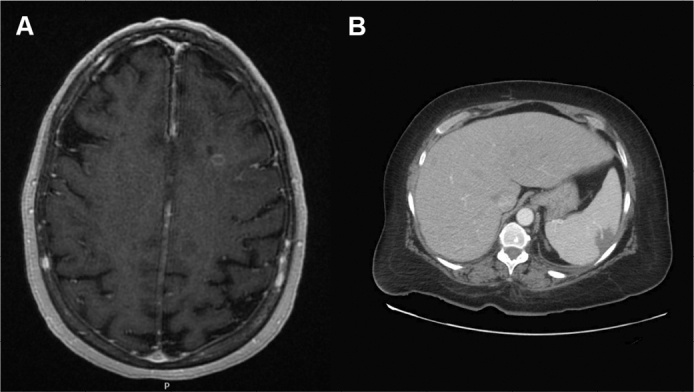 Figure 1: