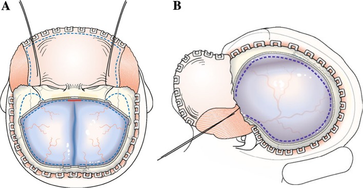 Fig. 4