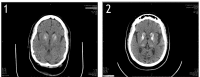 FIGURES 1 and 2.