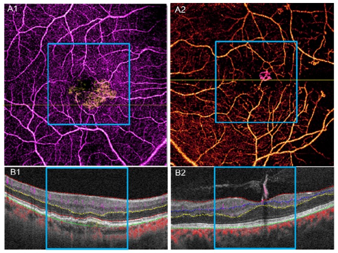 Fig. 12