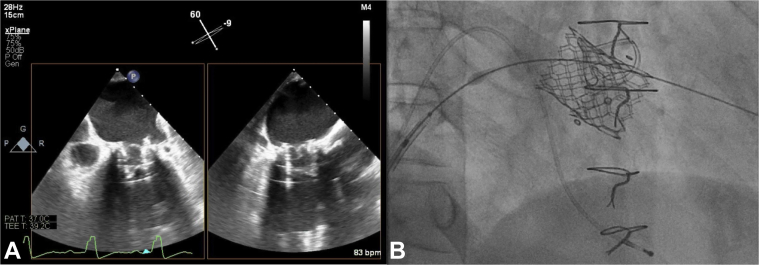 Figure 3