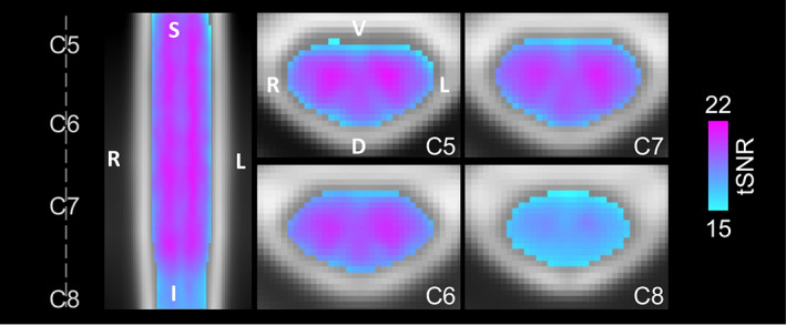 FIGURE 3