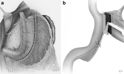 Fig. 4a and b