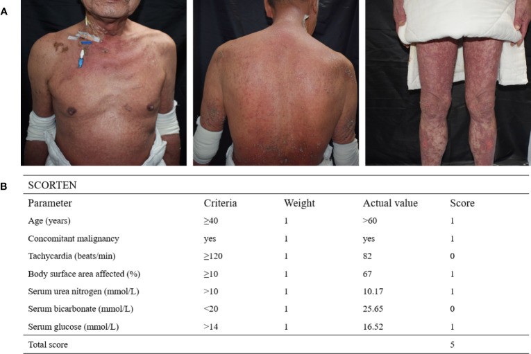 Figure 1