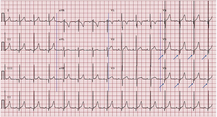 Fig. 3.