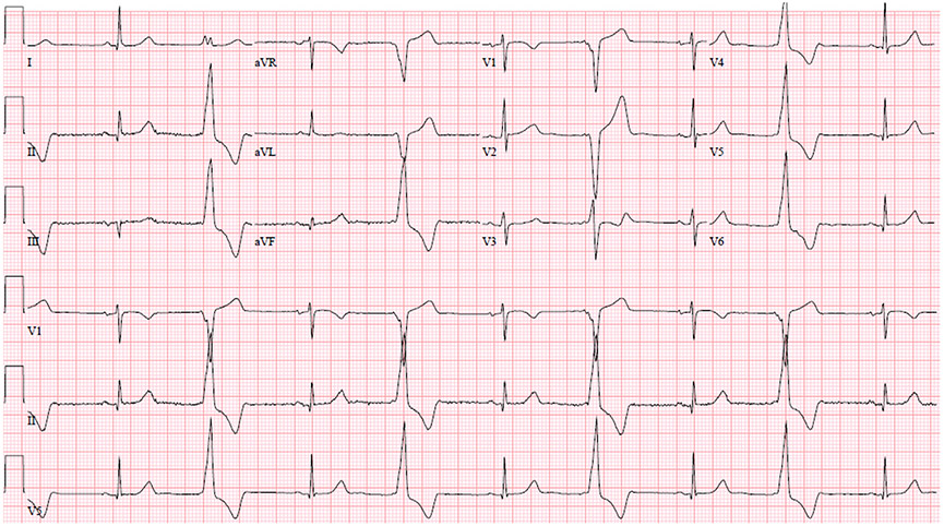 Fig. 6.