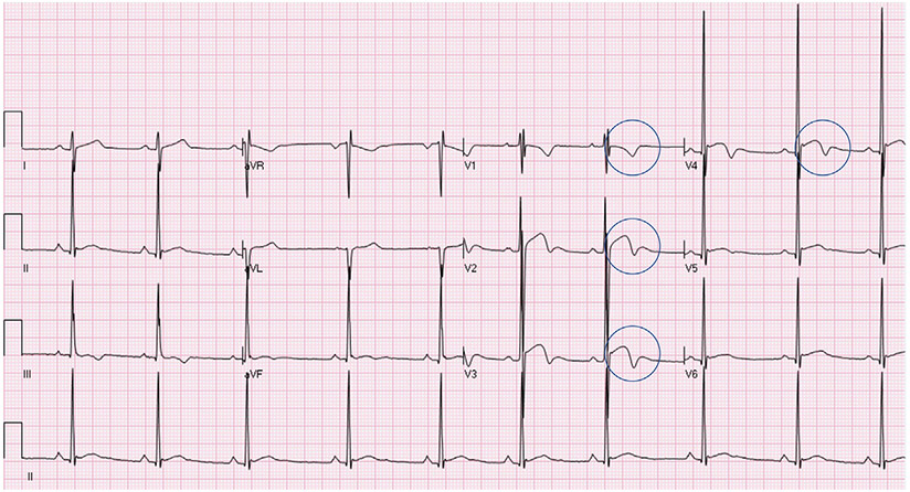 Fig. 2.