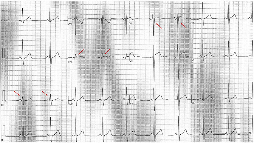 Fig. 5..