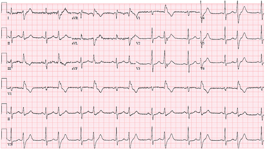 Fig. 7..