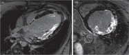 Fig 1.