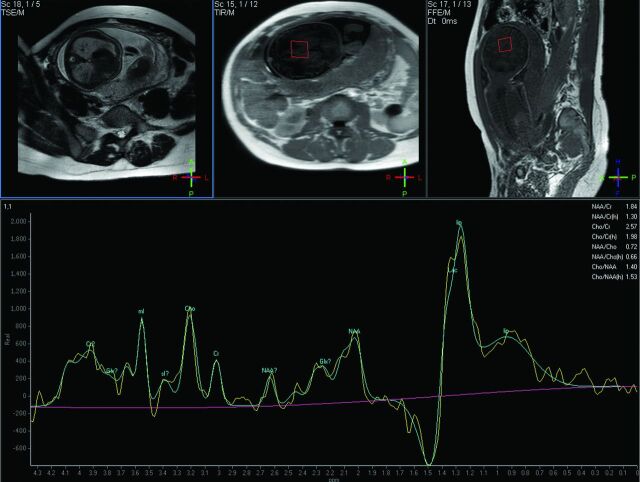 Fig 4.