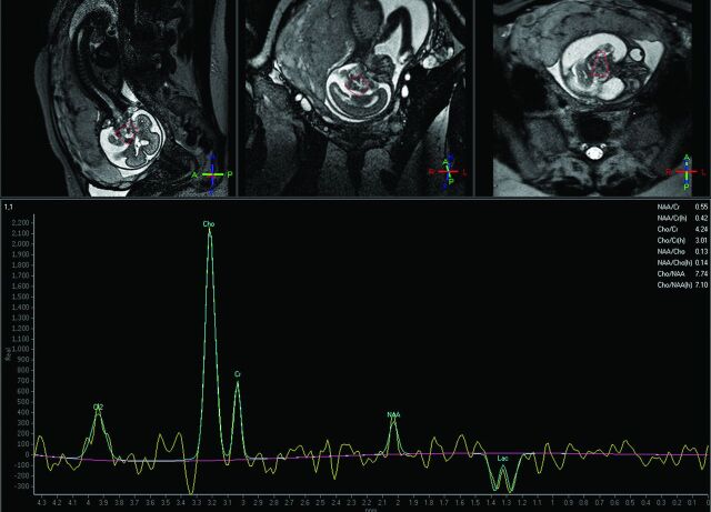 Fig 3.