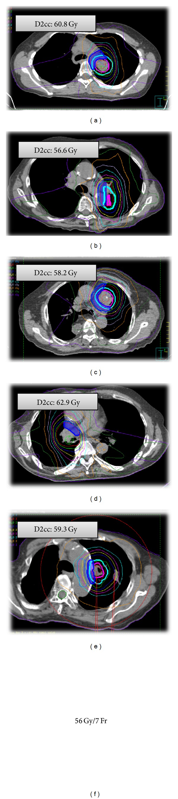 Figure 11