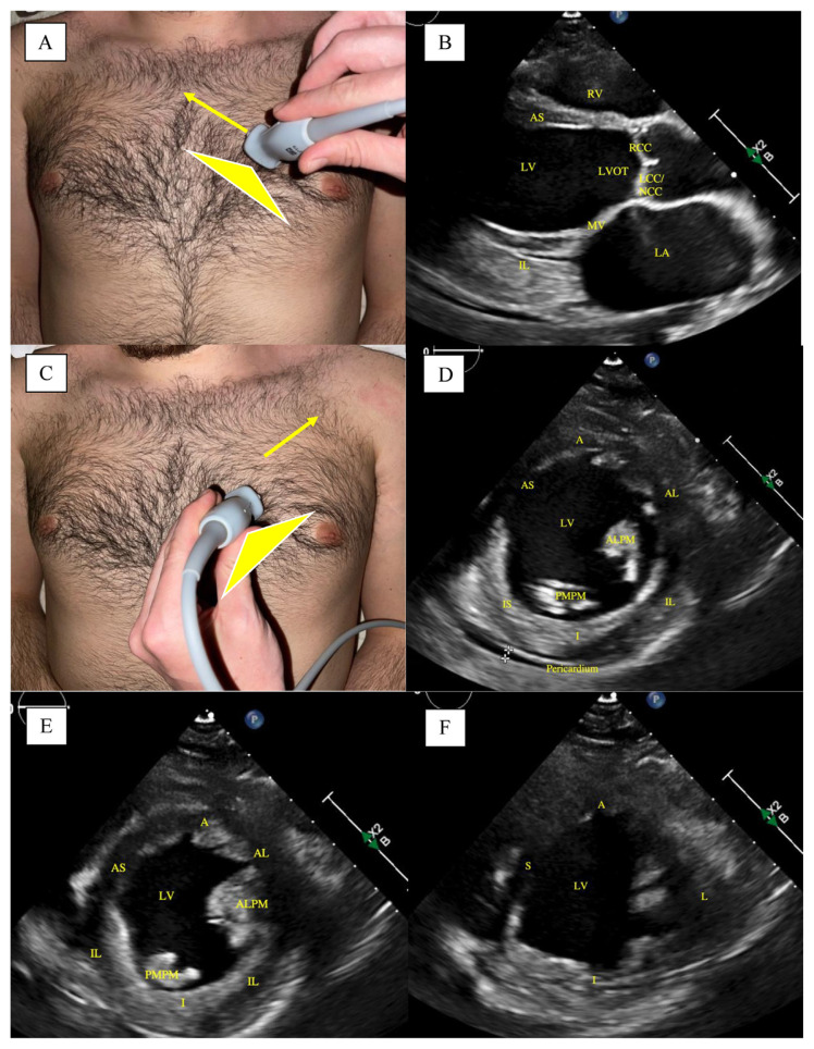 Fig. 1