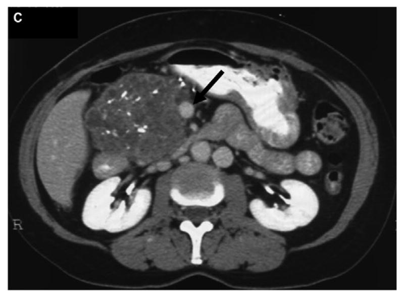 Figure C