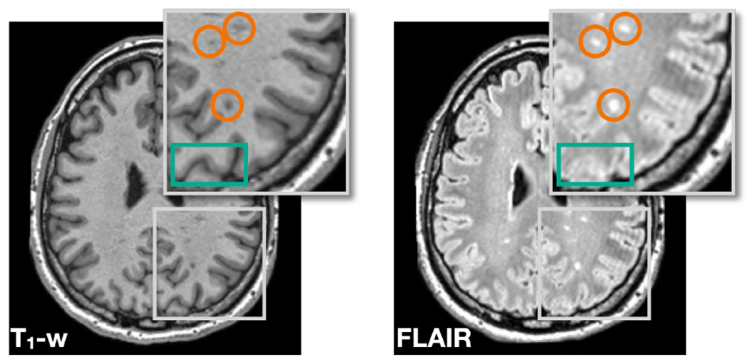 Figure 2: