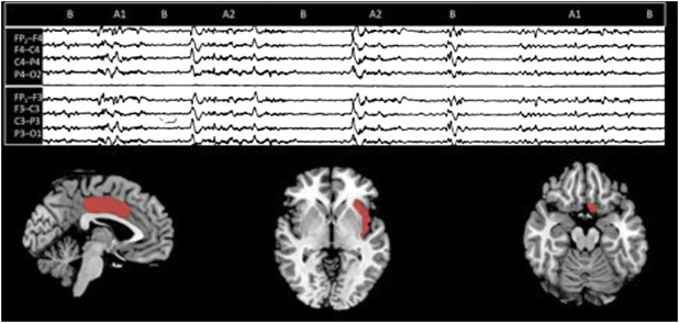 FIGURE 2