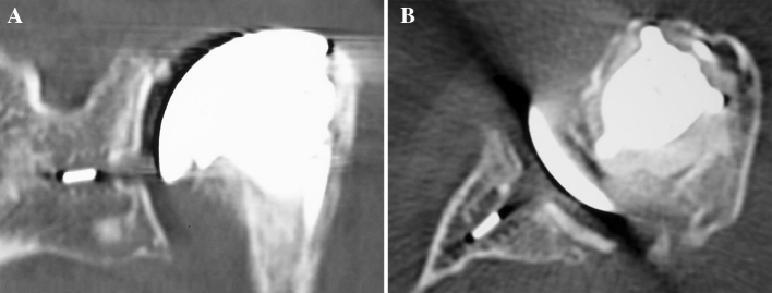 Fig. 5