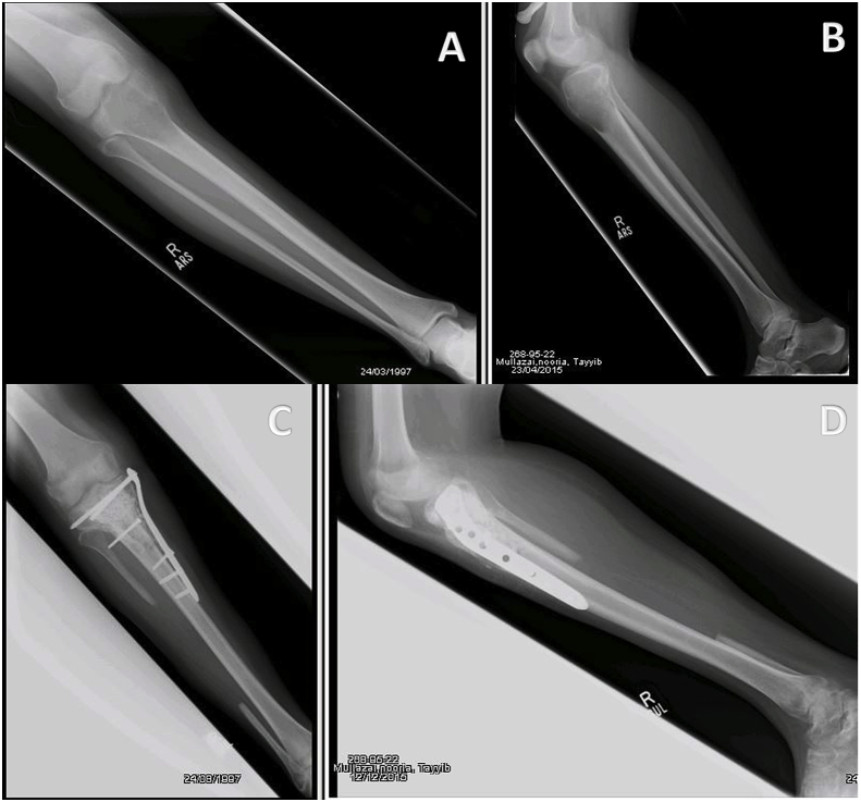 Fig. 4