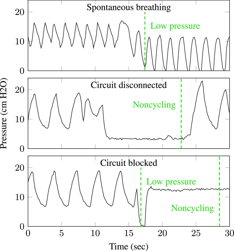 Fig. 11.