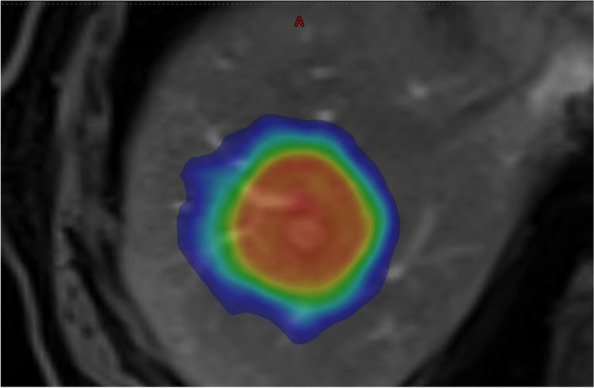 Fig. 2