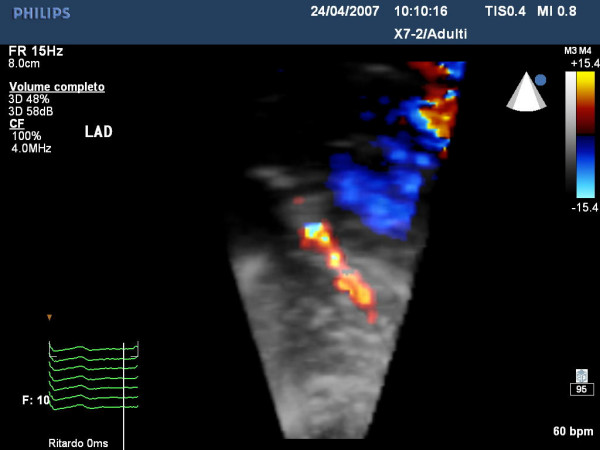 Figure 15