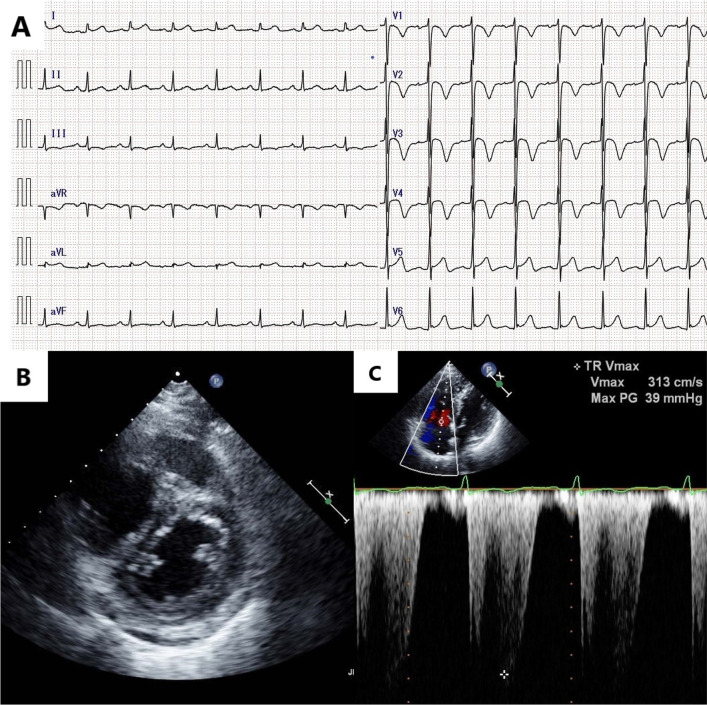 Fig. 2