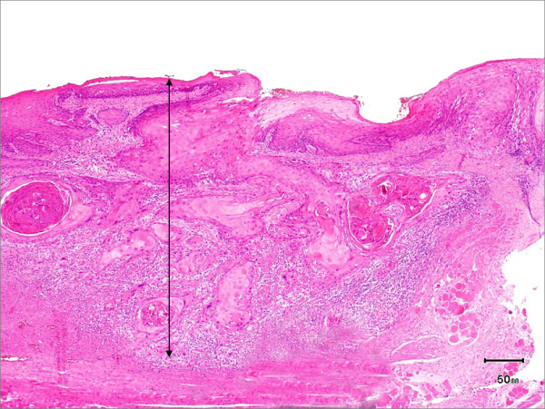 Figure 14