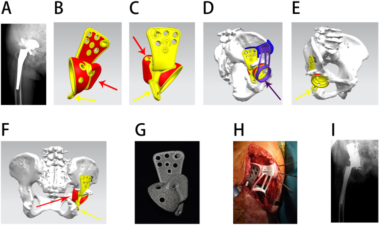 Figure 3