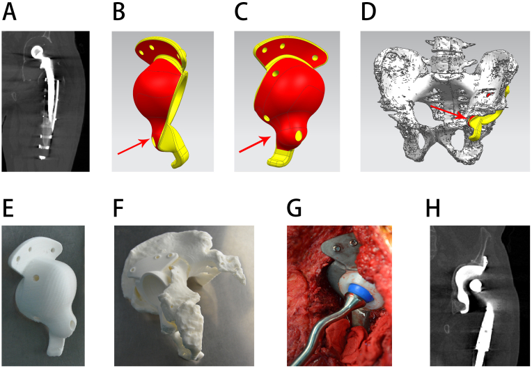 Figure 4