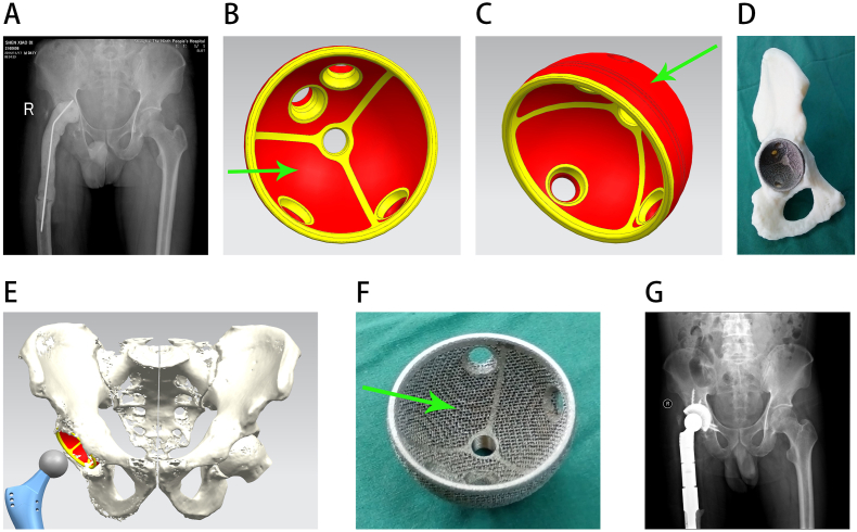 Figure 2