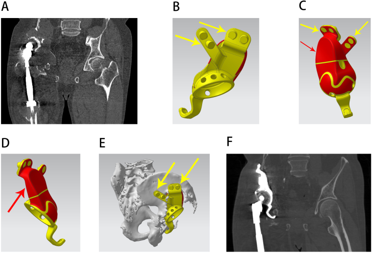 Figure 5