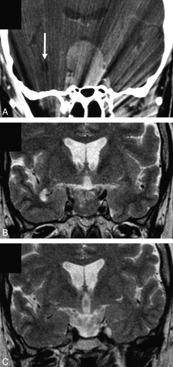 Fig 1.