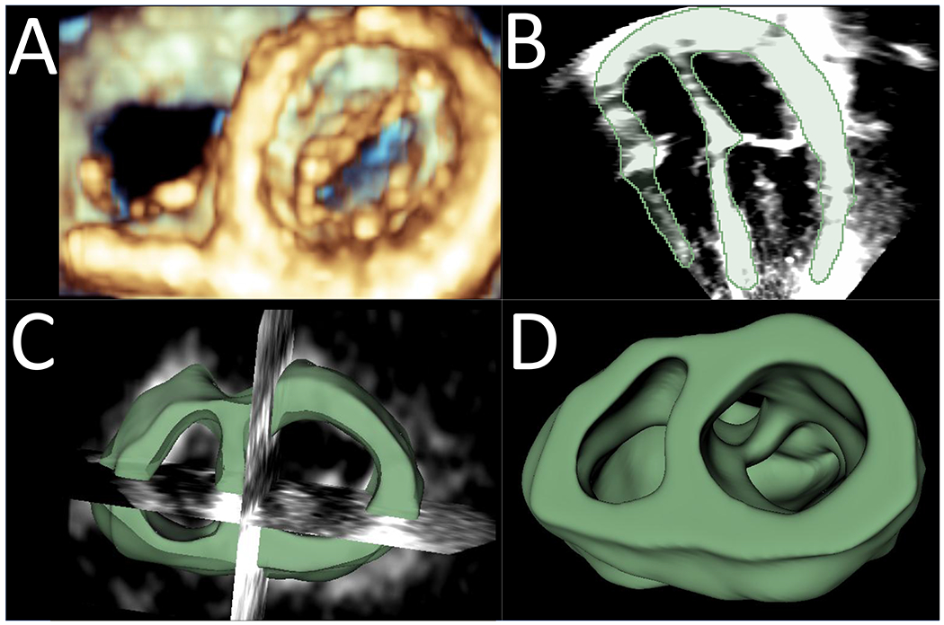 Figure 1: