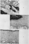 192-5