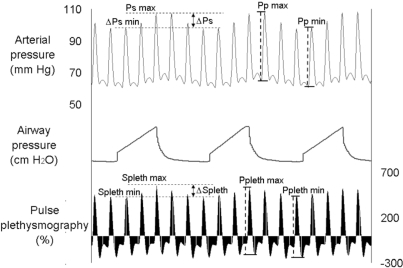 Figure 1 -