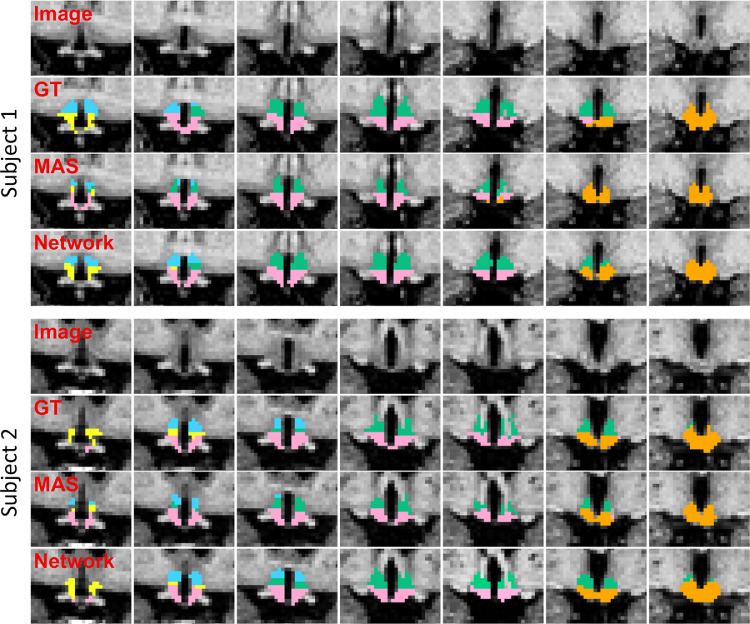 Fig. 4